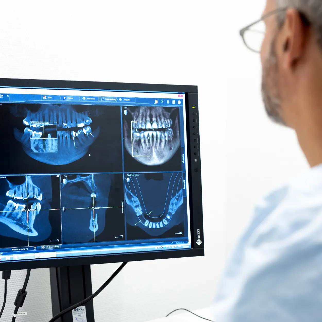 Bildschirm mit Röntgenbildern vom Kiefer | Gemeinschaftspraxis Dr. Dr. Jürgen Wahn - Dr. Dr. Tassilo Illg
